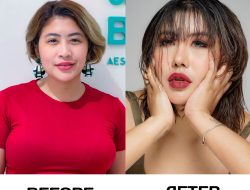 Aprilia Sky Jalani Operasi Wajah Kedua di Korea Selatan, Tampil Lebih Muda dan Fresh