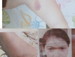 Kasus Dugaan Penganiayaan di Kubu Raya Mandek 4 Bulan, Korban Desak Polda Kalbar Segera Tindak Lanjut