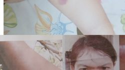 Kasus Dugaan Penganiayaan di Kubu Raya Mandek 4 Bulan, Korban Desak Polda Kalbar Segera Tindak Lanjut